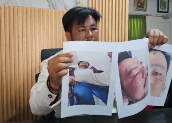 Kuasa Hukum AMPB Ngaku Dianiaya Aparat saat Demo Lengserkan Sudewo