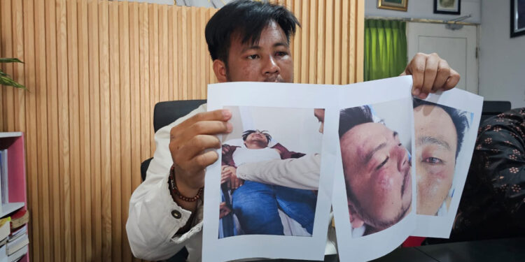 Kuasa Hukum AMPB Ngaku Dianiaya Aparat saat Demo Lengserkan Sudewo