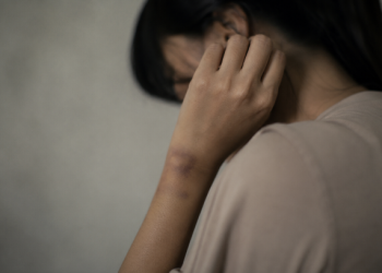 ​Bantah Pacaran, Wanita di Sinomwidodo Pati Dibacok Karena Tolak Ta’aruf