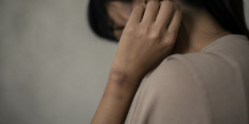​Bantah Pacaran, Wanita di Sinomwidodo Pati Dibacok Karena Tolak Ta’aruf
