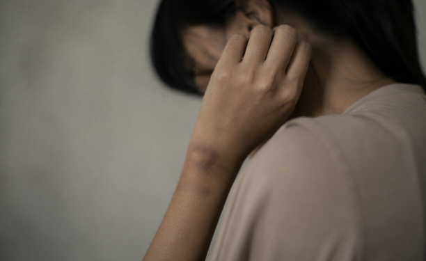 Bantah Pacaran, Wanita di Sinomwidodo Pati Dibacok Karena Tolak Ta’aruf